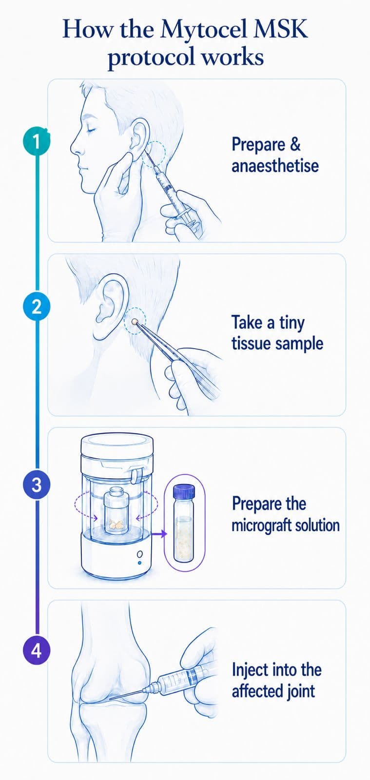 How the Mytocel MSK protocol works, in four steps: prepare and anaesthetise the ear, take a tiny tissue sample, prepare the micrograft solution, and inject it into the affected joint.